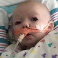 A young baby girl suffering from a highly contagious respiratory infection due to people with non-wa...