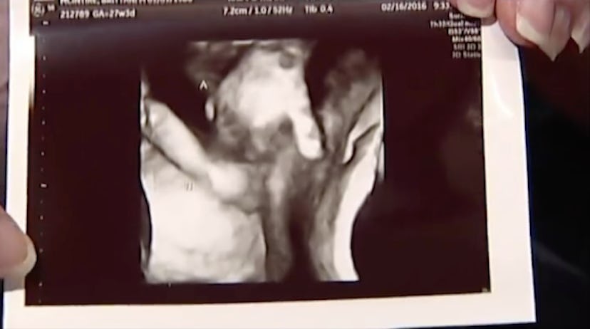 twins-holding-hands-ultrasound