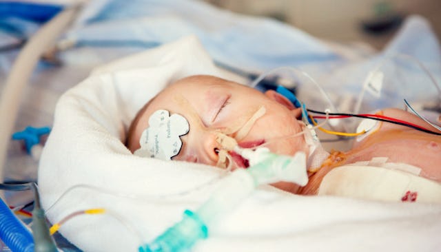 congenital heart disease