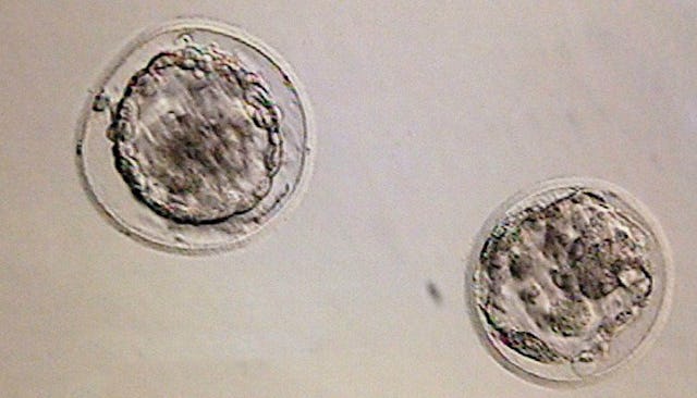 Two embryos that didn't implant