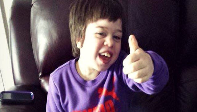 hunter syndrome
