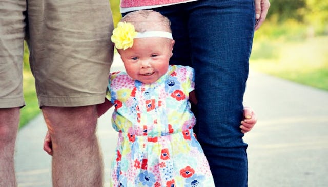 physical differences