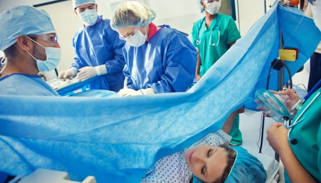 c-section