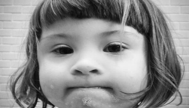 Down syndrome
