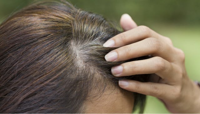gray hair