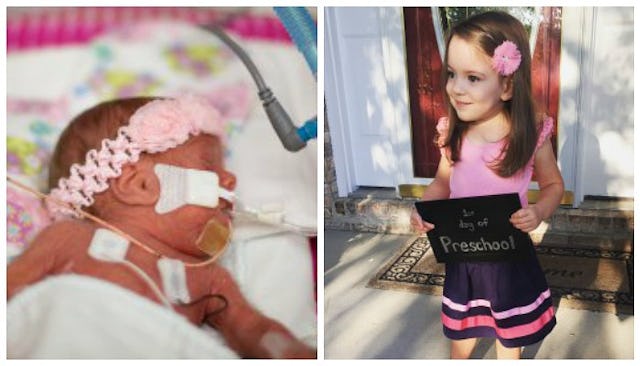 Picture of a premature newborn baby in a hospital bed and a picture of a happy girl wearing pink clo...