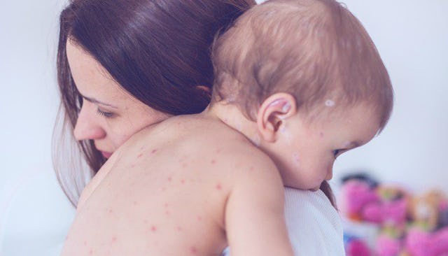 childhood illnesses