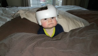 A baby boy wearing a white helmet in order to properly shape the baby's head