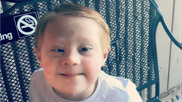 A child with Down Syndrome sitting on a blue chair directly facing the camera and smiling in a white...