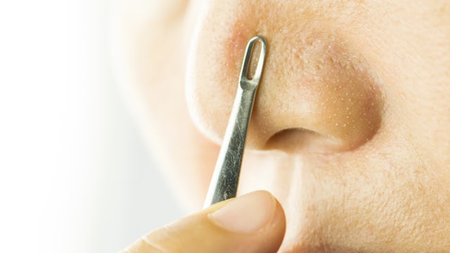 Nose with black spots