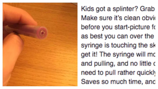 Mom’s Genius Trick For Removing Splinters Is The Best Parenting Hack Ever