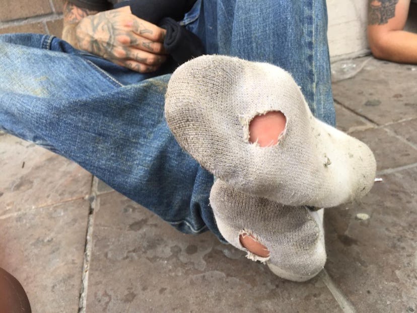 White torn socks worn by a homeless man