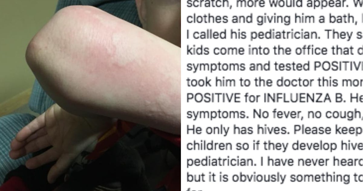 Nurse’s Warning About Unexpected Flu Symptom Goes Viral