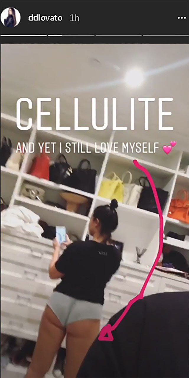 Demi Lovato Shares Pictures Of Her Cellulite ‘I Still Love Myself’