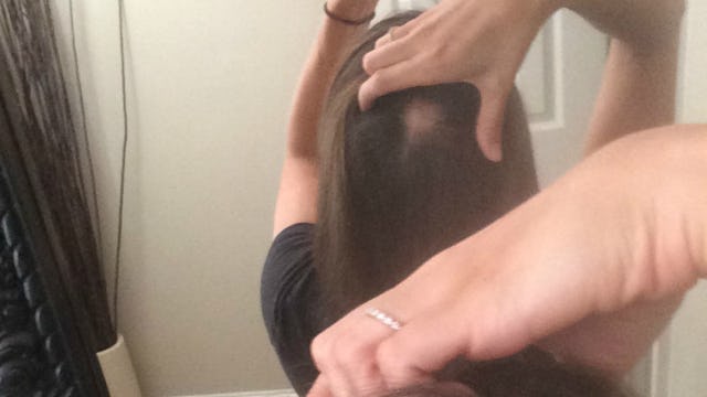 Katie Malone' hair loss visible on the back of her head in a mirror photo