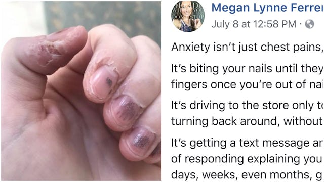 A two-part collage with bitten nails on the left and a status about what it is like to have anxiety.