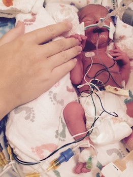 A newborn baby in the NICU strapped to hospital devices wrapped around with a white blanket