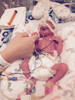 A newborn baby in the NICU strapped to hospital devices with a white blanket underneath