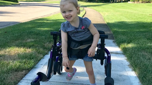 Little girl with a rare chromosome deletion in a wheelchair.