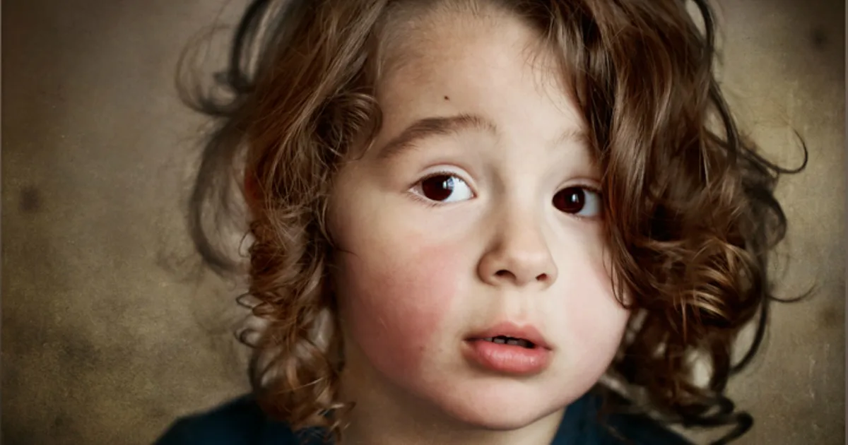 What To Know If Your Child Has That ‘Slapped Cheek’ Rash