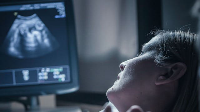 A mother lying on a bed while looking at her child on the ultrasound monitor