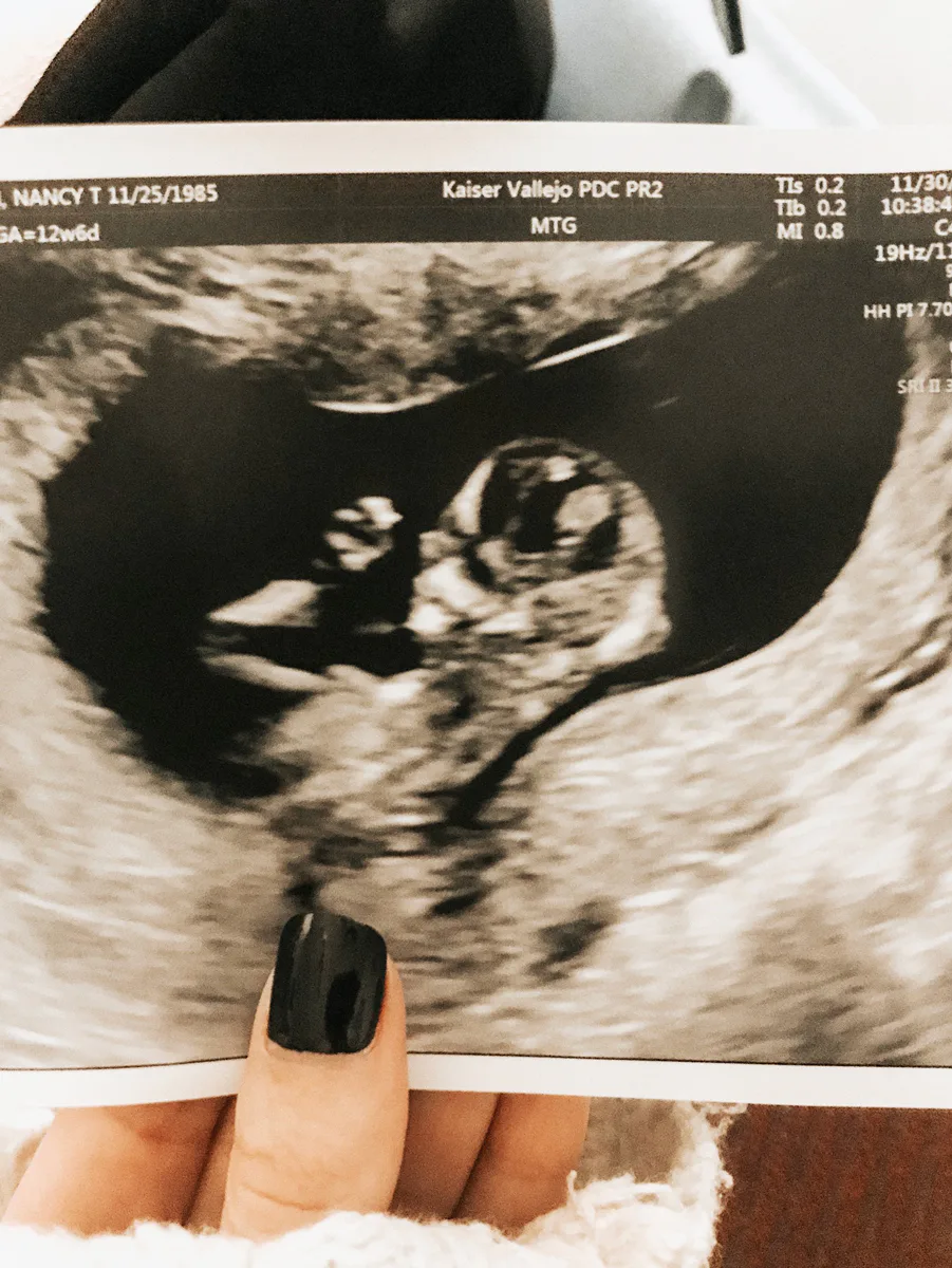 UNMARRIED AND PREGNANT ADVICE PLEASE intelligence overview