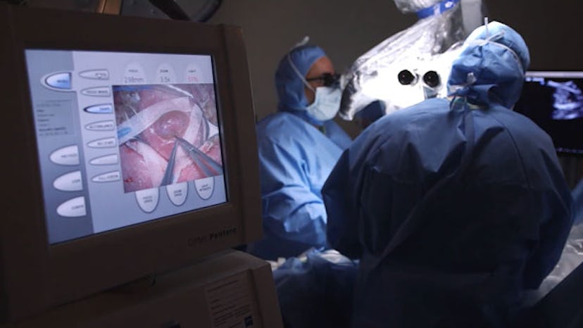 Doctors performing the fetal spina bifida surgery and looking at a monitor.