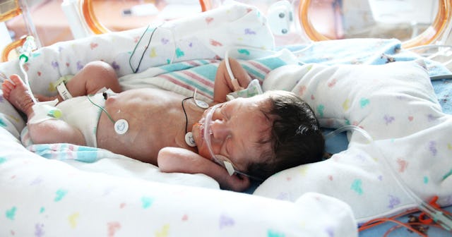 Newborn baby in hospital with wires attached to skin 