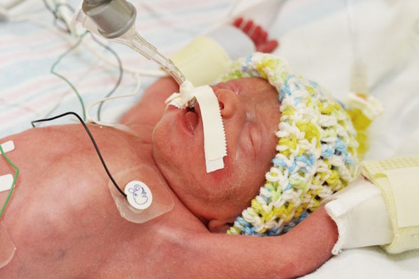 Preemie baby connected to medical equipment