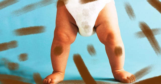 Let's Talk About Toddlers And Scatolia: Baby legs with diaper