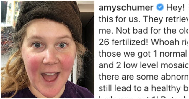 Amy Schumer IVF Instagram post