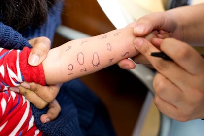 child is tested for allergic reactions to various substances at an allergy clinic