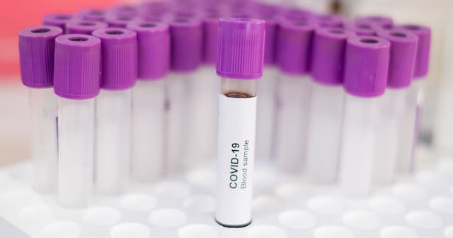 coronavirus test stock image