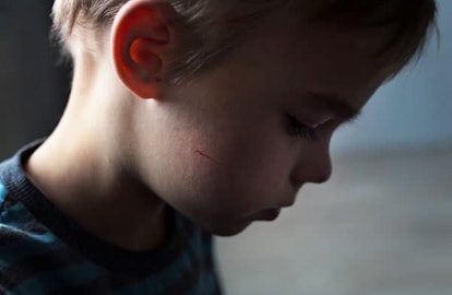 The Pandemic Is Causing An Increase In Child Abuse: boy with cut on his cheek