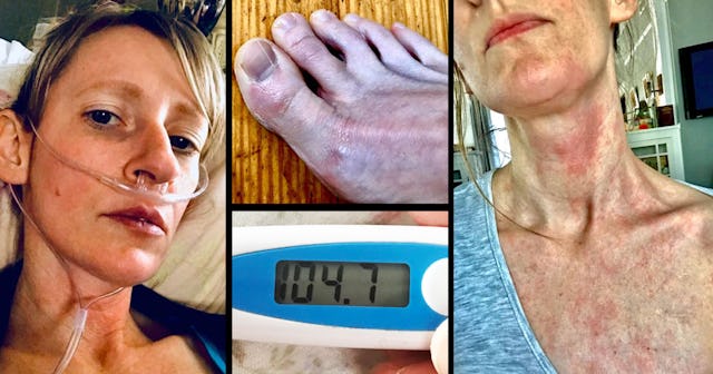 Take It From Me, COVID-19 Is Not Just A 'Bad Flu'