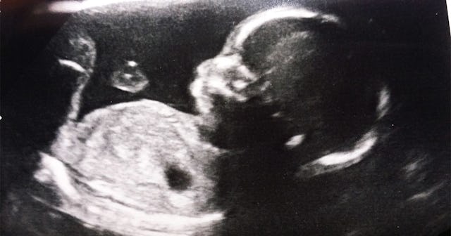 Baby scan