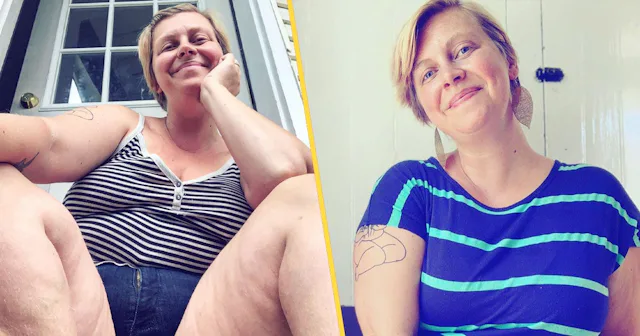 Cellulite Is Not The Problem