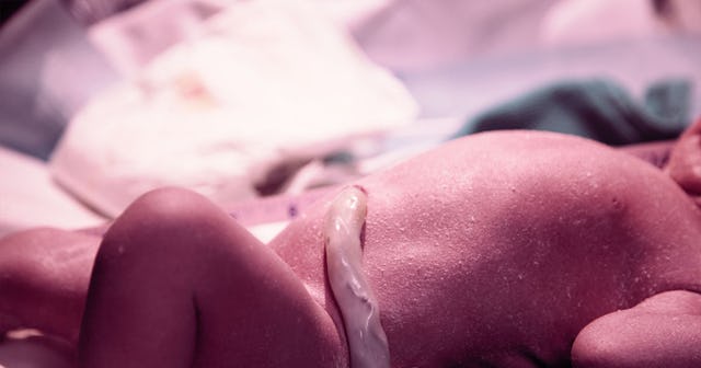 A baby lying on the back with the cord connected to its belly
