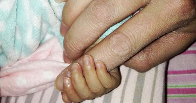 I Lost One Of My Twin Daughters -- A Loss Like This Changes You Forever