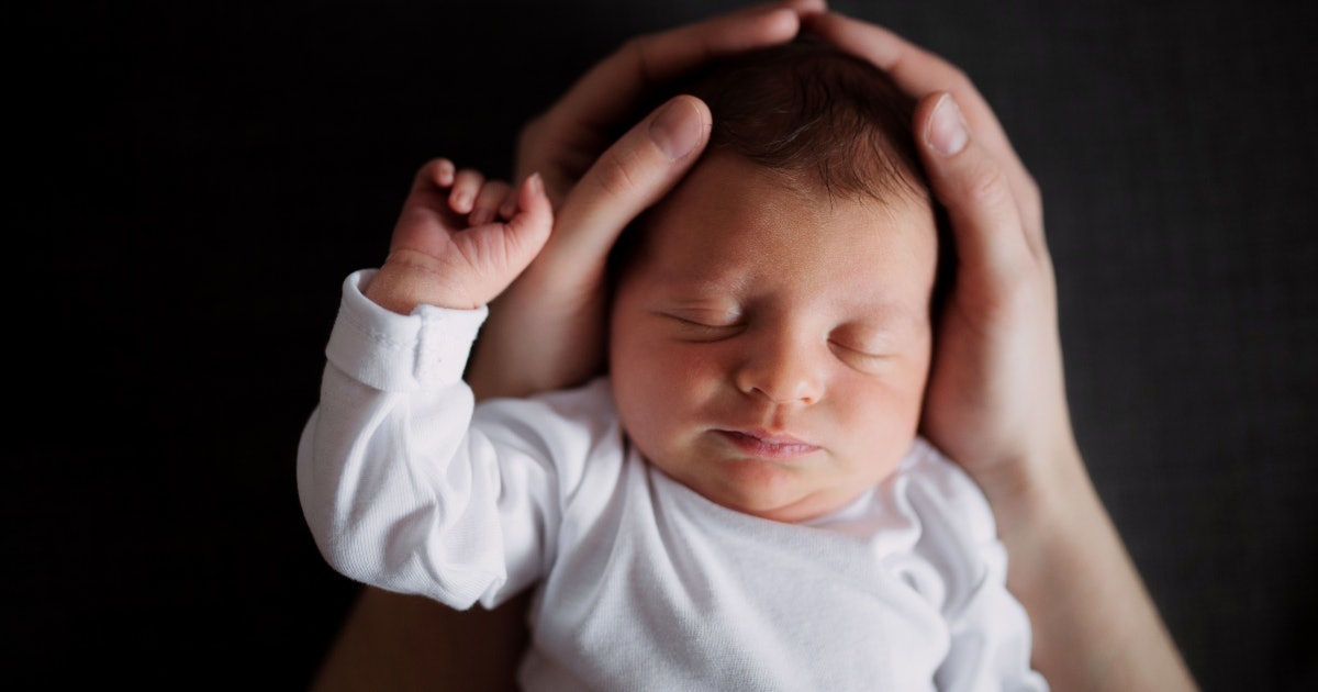 infant misshapen head