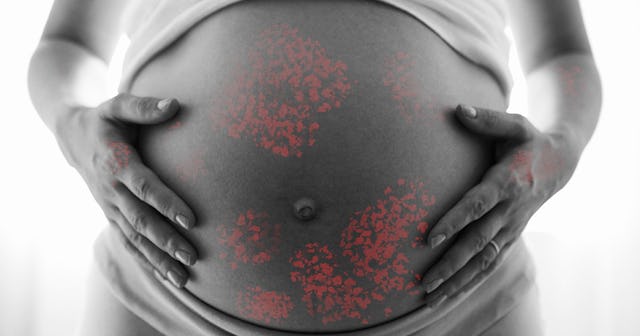 A pregnant woman holding her belly in black and white with red markings over the belly