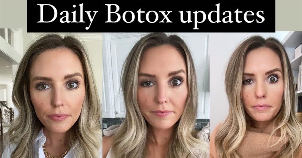 Blogger Opens Up About Her Experience With Ptosis –– A Rare Botox Side Effect