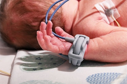 A newborn lying in a bed at NICU while getting a treatment