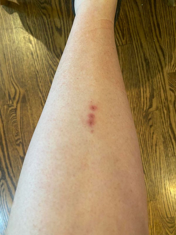 That Time I Went To The OB-GYN With Toilet Paper Hanging Off Of Me