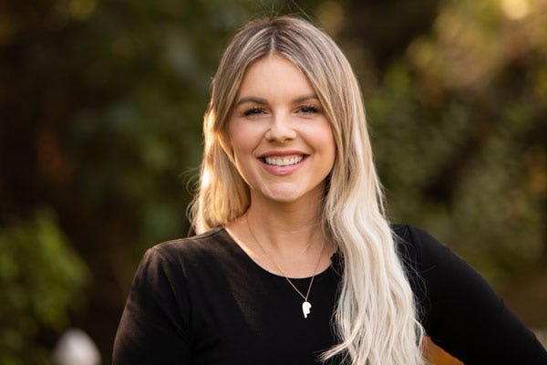 Ali Fedotowsky Says ‘I Have Shingles At 36,’ And Details Her Symptoms