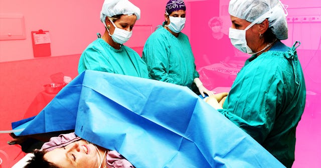 A woman getting a C-section and three doctors around her