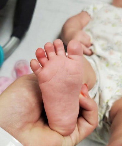 A closeup of a mum's hand holding a baby's foot which had a swollen toe because a hair strand got ar...