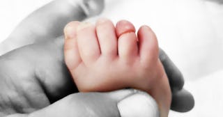 A closeup of a doctor's hand holding a baby's foot, which had a swollen toe because a hair strand go...