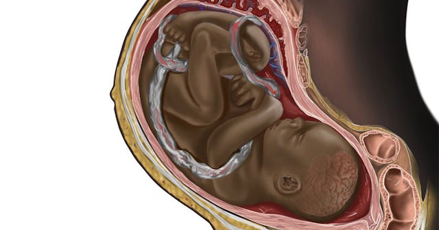 An anatomical illustration of a black fetus in a mother's stomach