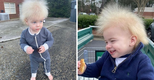 uncombable hair syndrome